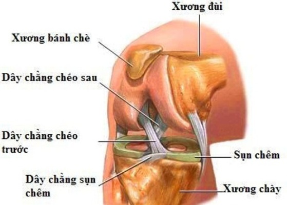 Chấn thương dây chằng đầu gối - Hình ảnh minh họa